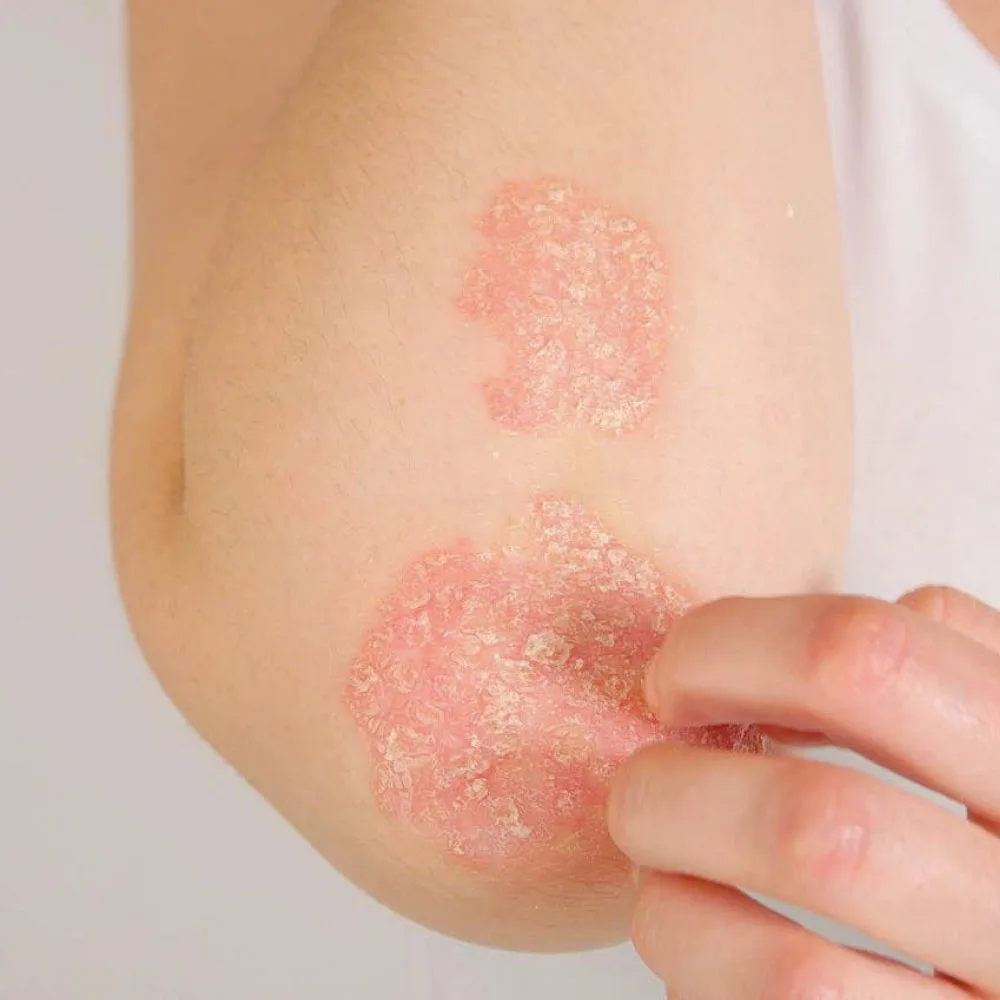 ALPHANOVA Thermal Care intensiivselt taastav rikkalik kehakreem, 200ml - Image 3